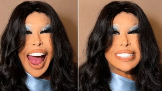 Bülent Ersoy estetik sonrası ilk kez görüntülendi