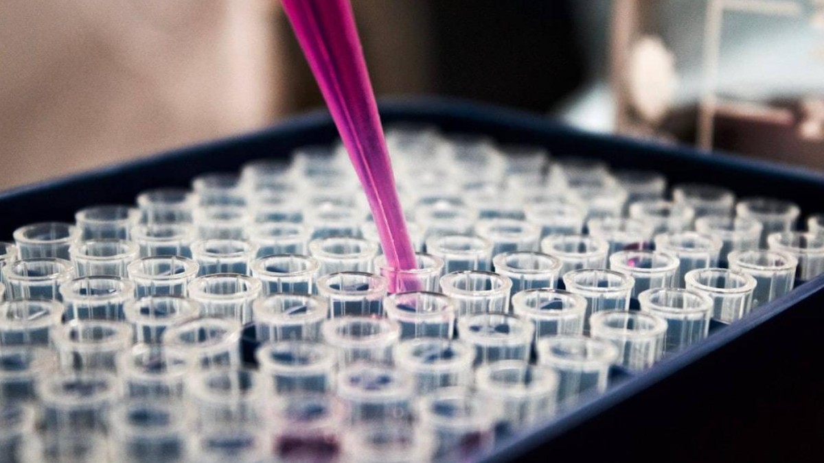 Yeni idrar testi mesane kanseri teşhisinde işlem yükünü azaltıyor