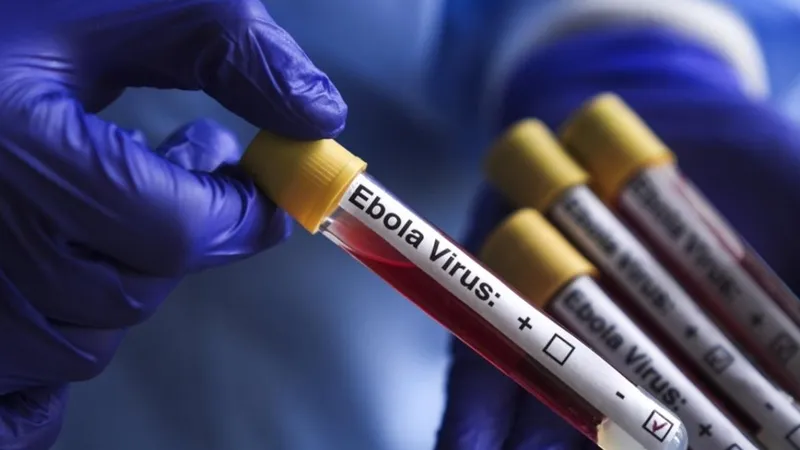 Fransa’da İlk Ebola Vakası Alarmı: Kongo’dan Dönen Doktor Karantinaya Alındı
