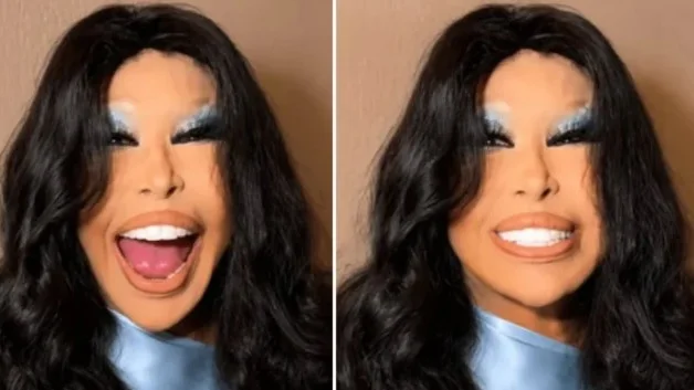 Bülent Ersoy estetik sonrası ilk kez görüntülendi