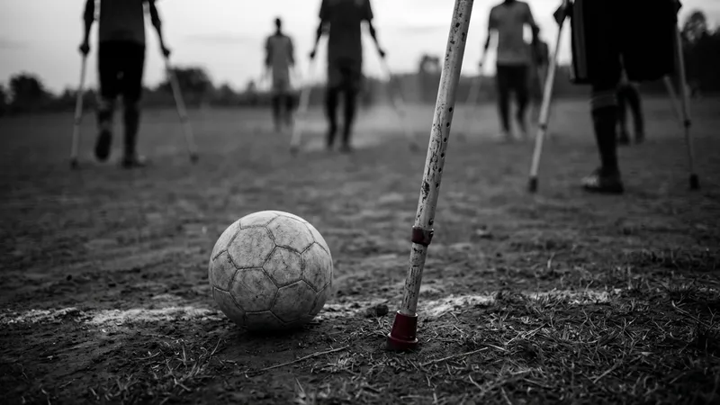 Amputee football fosters unity and rehabilitation in Rwanda